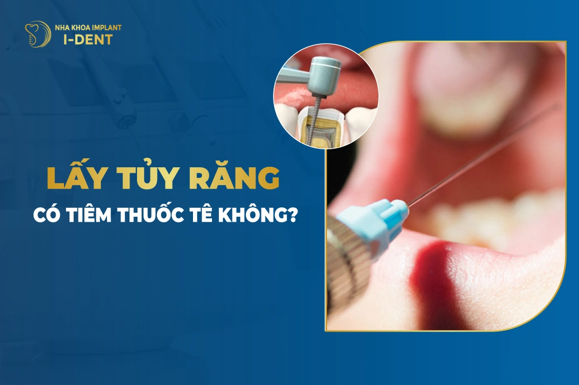 Lay Tuy Rang Co Tiem Thuoc Te Khong