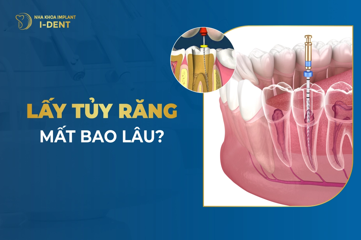 Lay Tuy Rang Mat Bao Lau