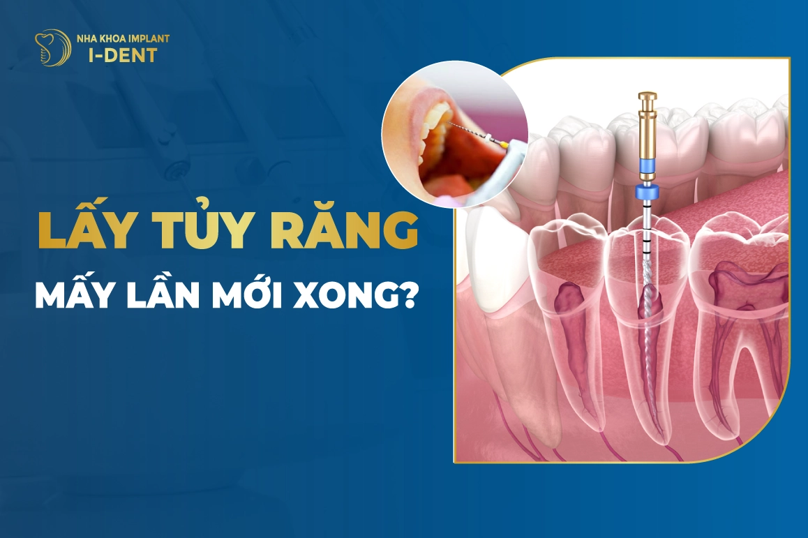 Lay Tuy Rang May Lan Moi Xong