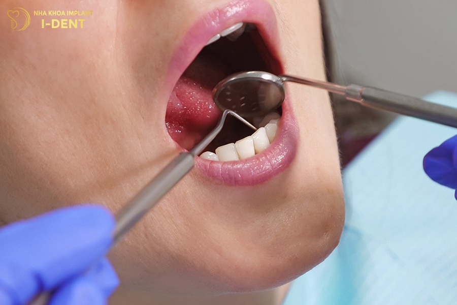Lựa chọn bác sĩ có tay nghề cao để tránh tác hại khi bọc răng sứ
