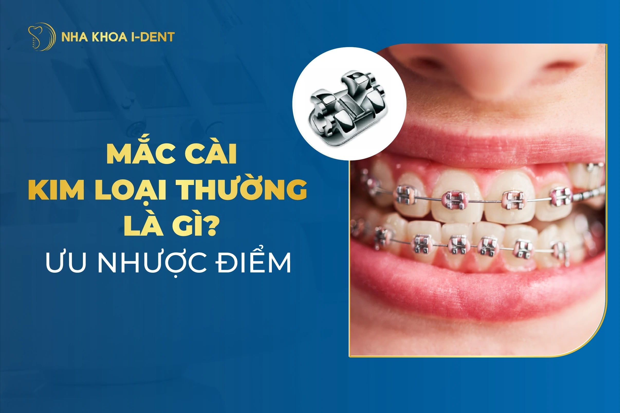 Mac Cai Kim Loai Thuong