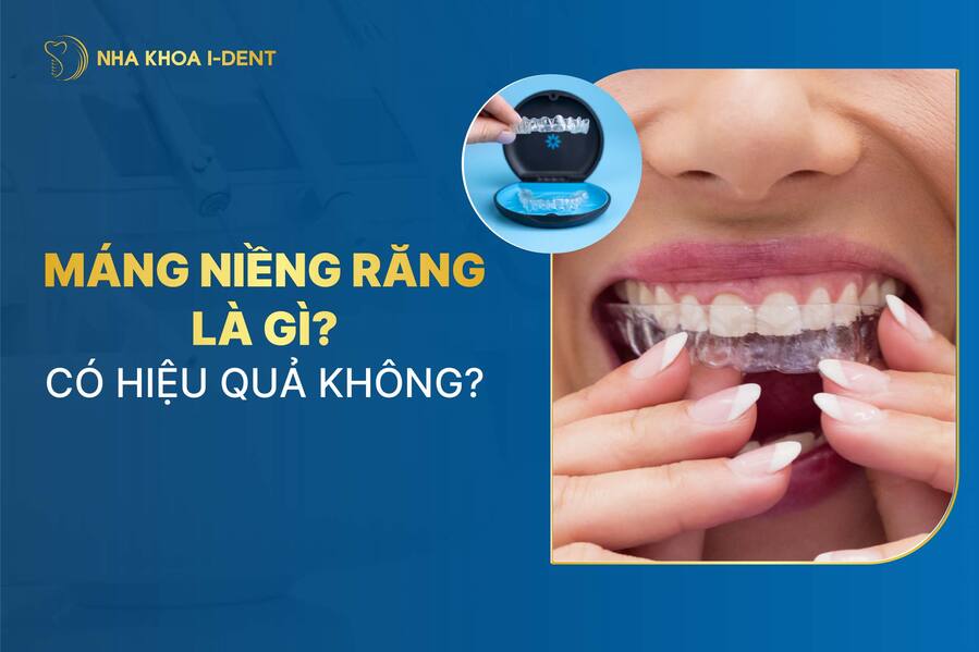 Mang Nieng Rang
