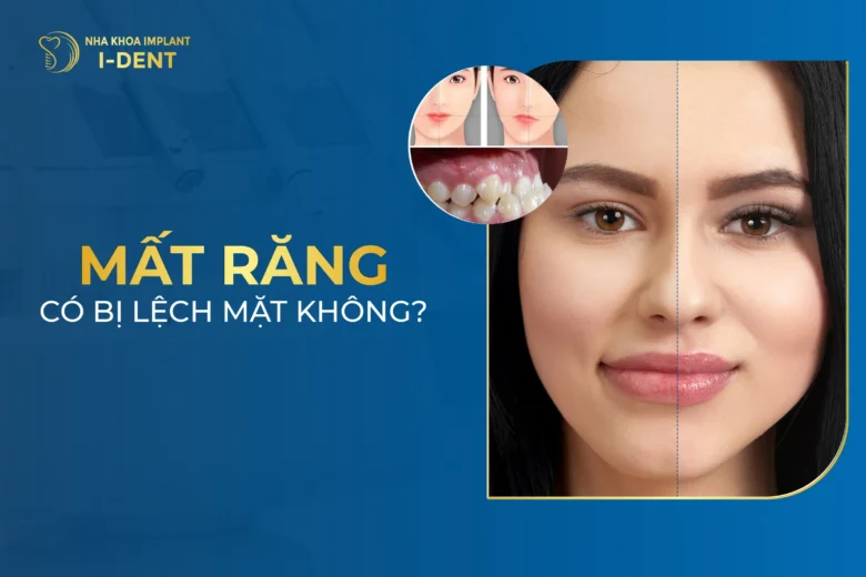 Mất Răng Có Bị Lệch Mặt Không? Phòng Ngừa Thế Nào?