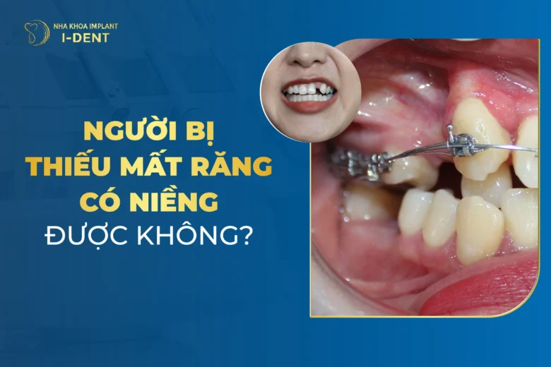 Người Bị Mất Răng Thì Có Niềng Được Không?