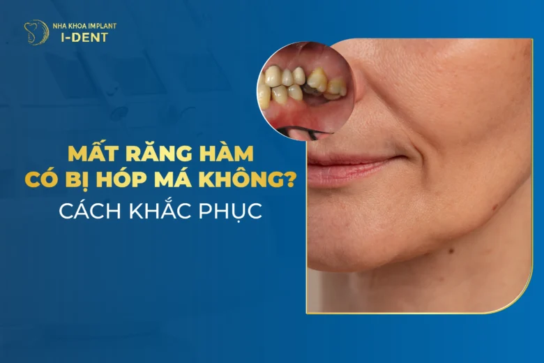 Mất Răng Hàm Có Bị Hóp Má Không? Cách Khắc Phục Hiệu Quả