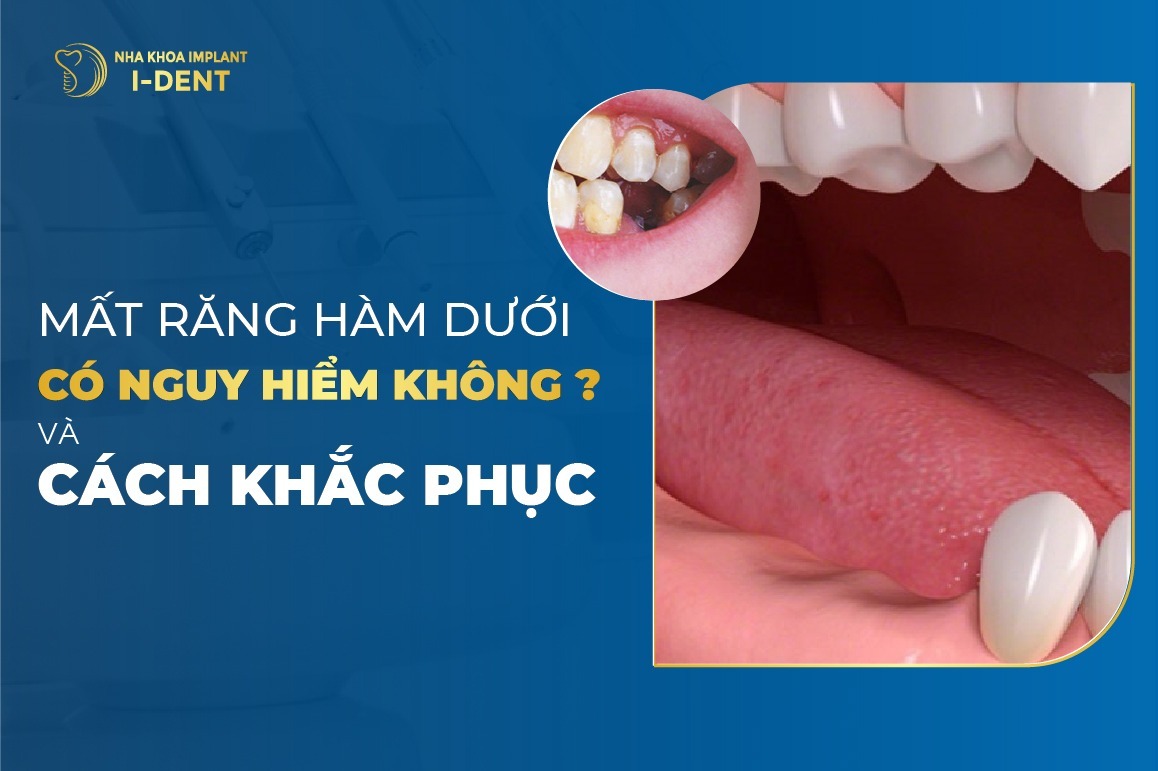 Mat Rang Ham Duoi Co Nguy Hiem Khong Cach Khac Phuc