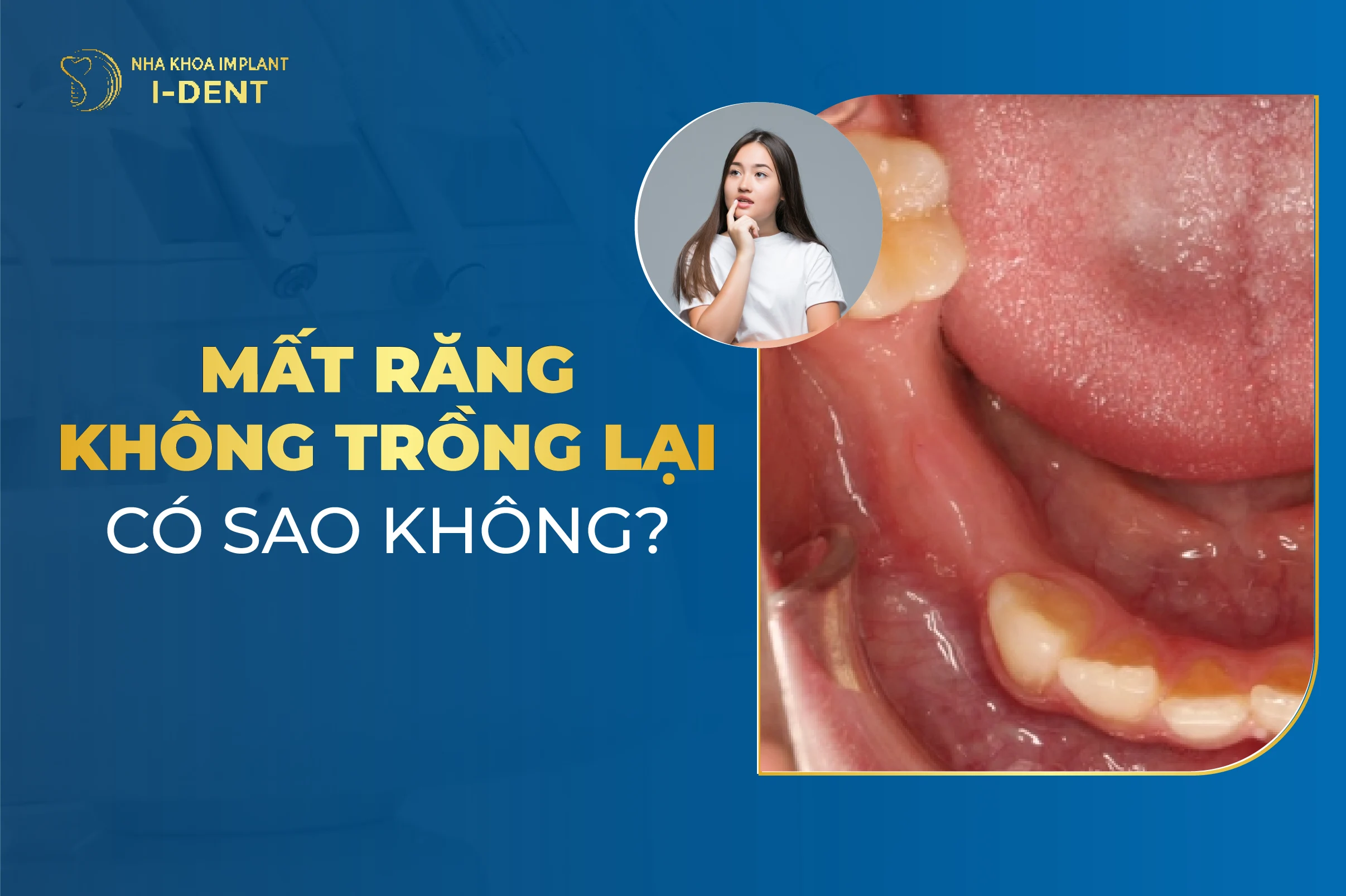 Mat Rang Khong Trong Lai Co Sao Khong
