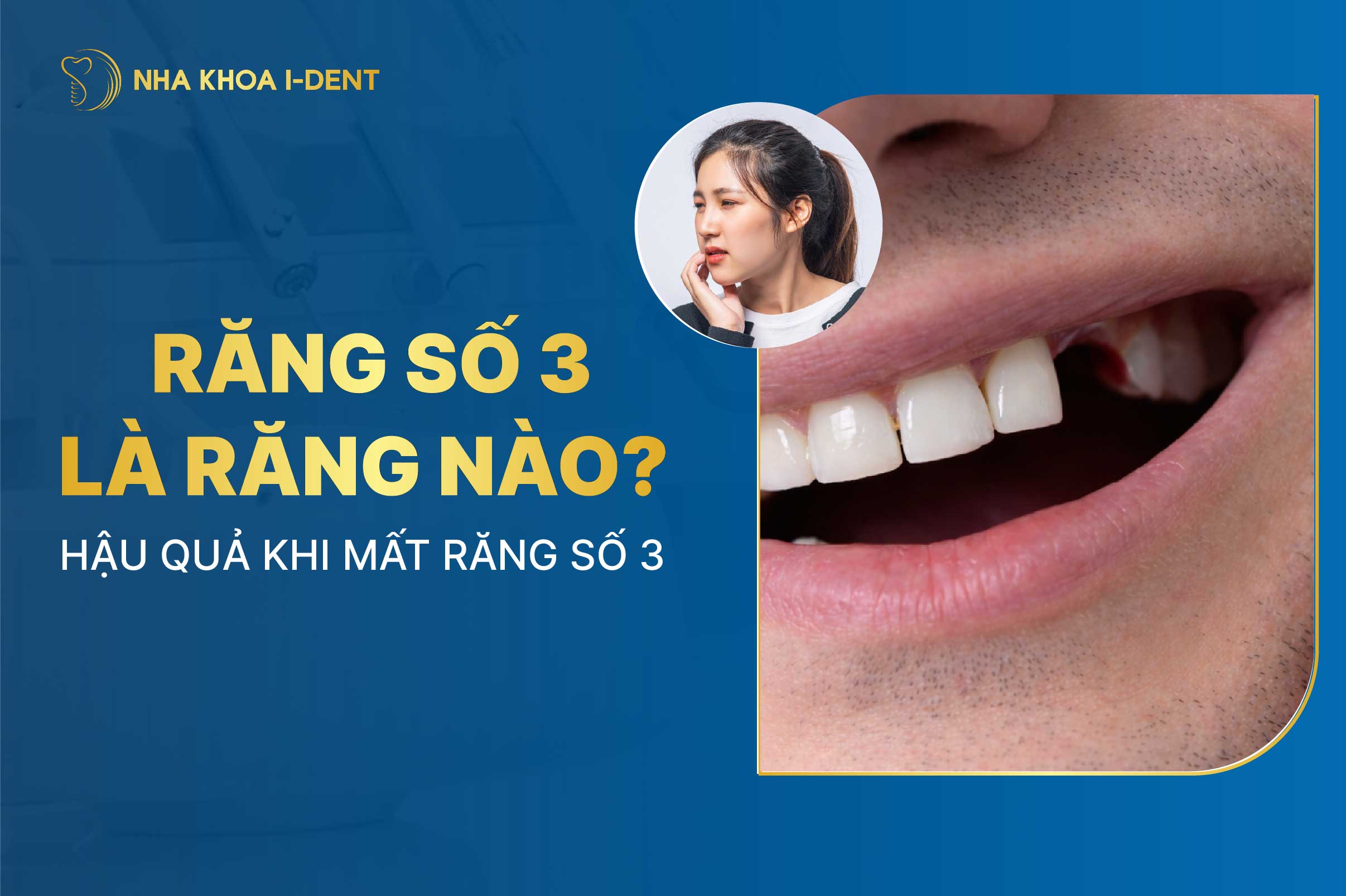 Mat Rang So 3