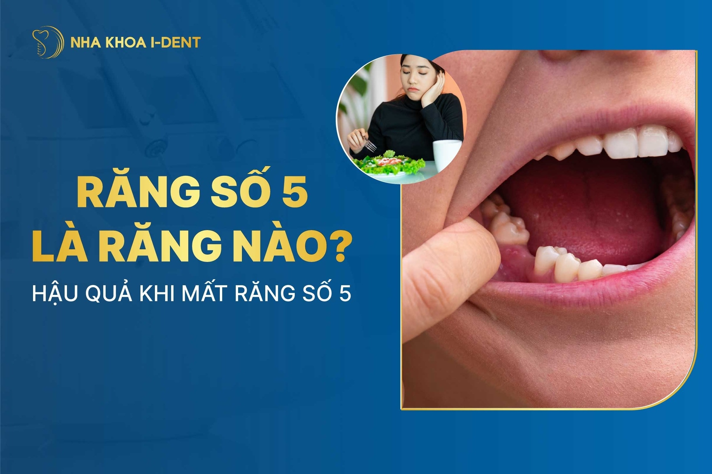 Mat Rang So 5 Rotated E1770783987166