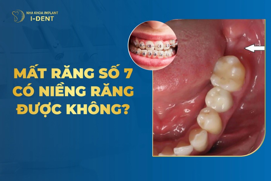 Mat Rang So 7 Co Nieng Rang Duoc Khong