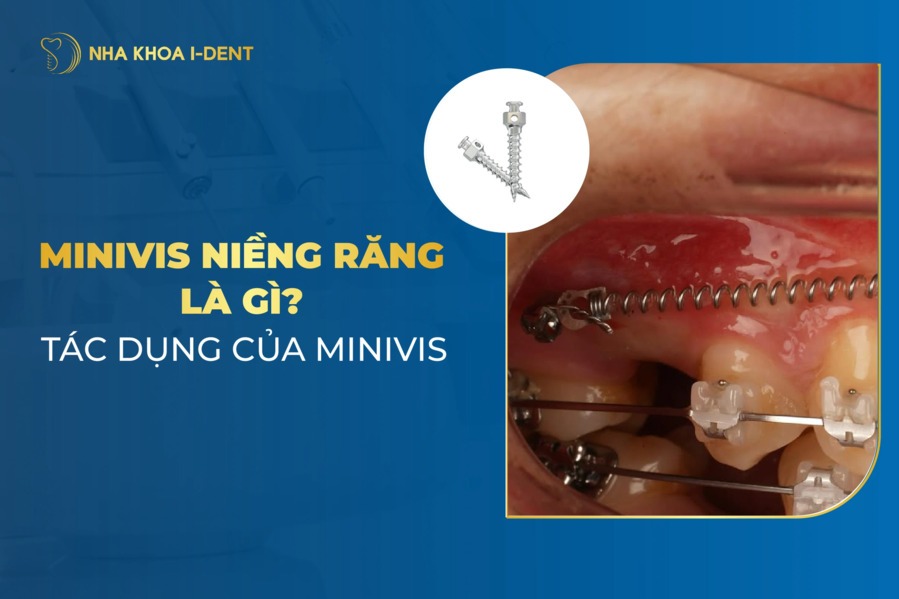 Minivis Nieng Rang