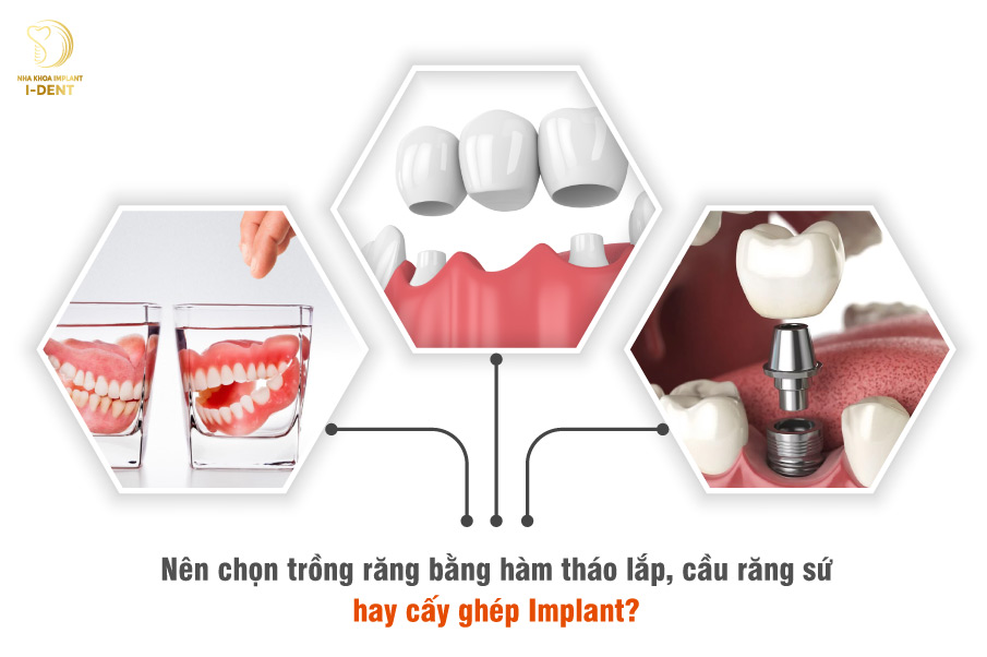 răng giả cho người già bao nhiêu tiền