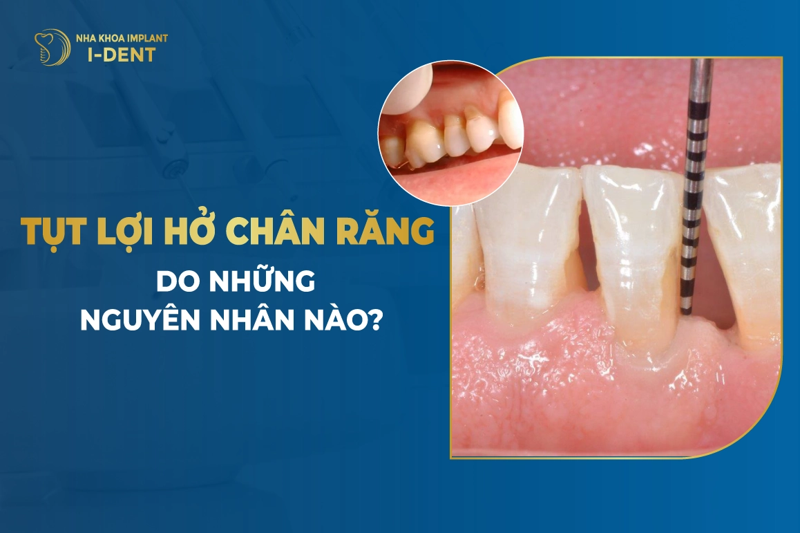 Nguyen Nhan Tut Loi Ho Chan Rang