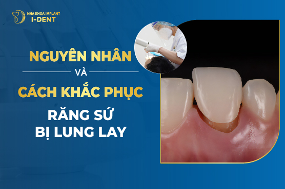 Nguyên Nhân Và Cách Khắc Phục Răng Sứ Bị Lung Lay