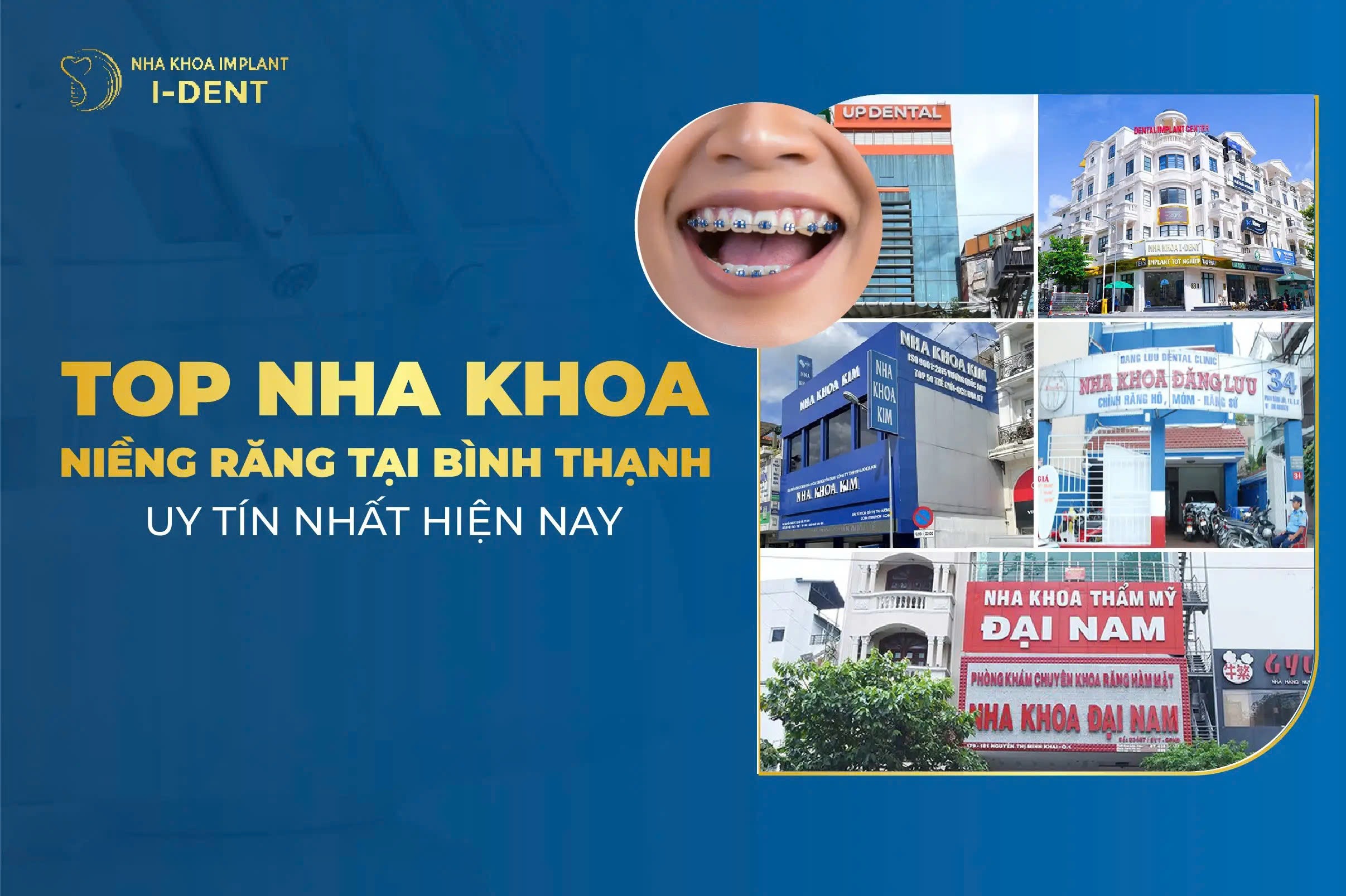 Nha Khoa Nieng Rang Tai Binh Thanh