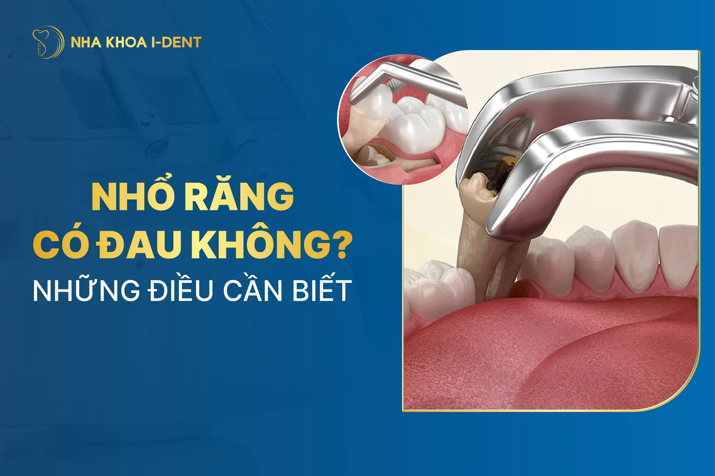 Nho Rang Co Dau Khong