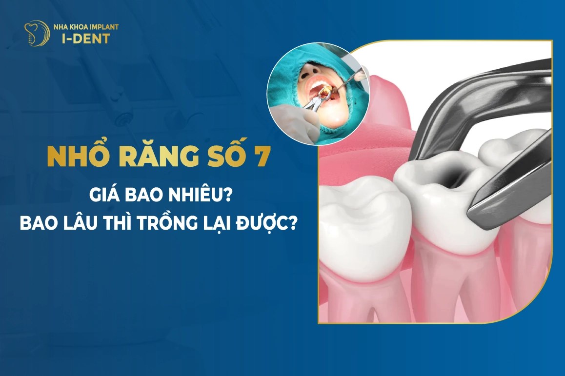Nho Rang So 7 Gia Bao Nhieu