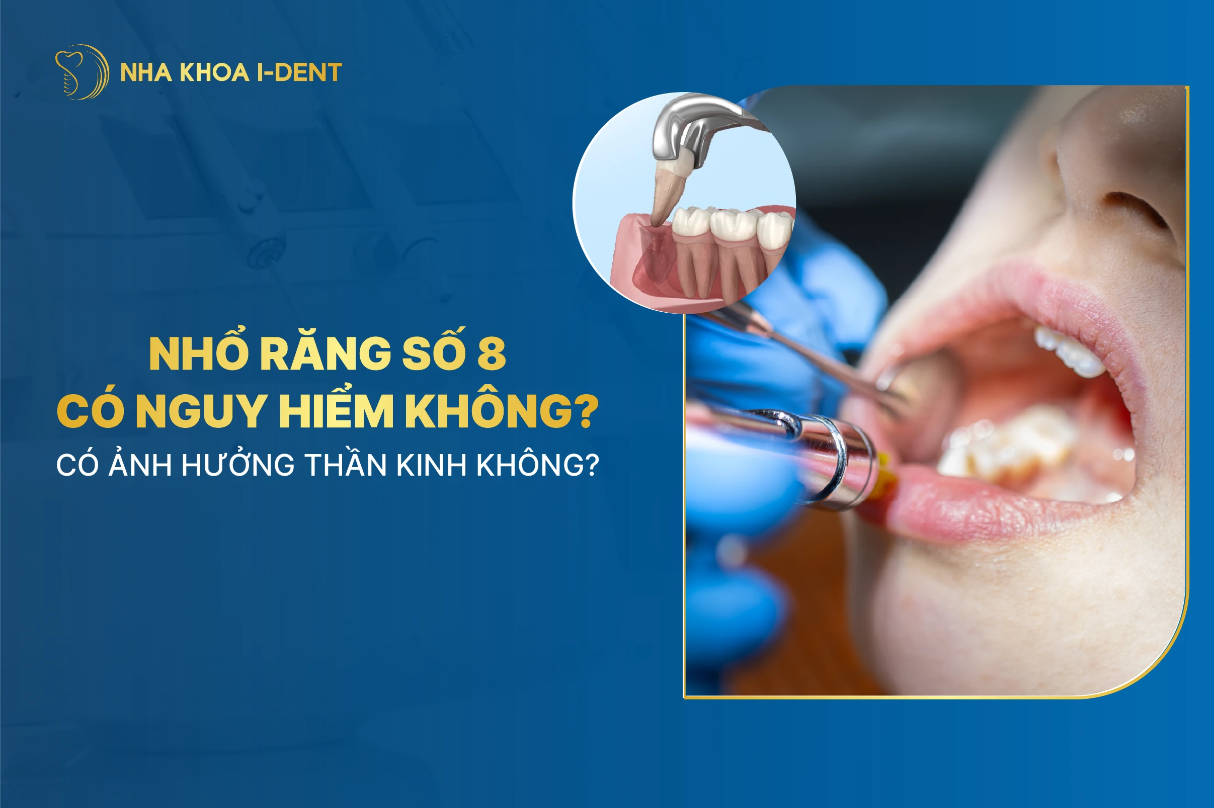 Nho Rang So 8 Co Nguy Hiem Khong