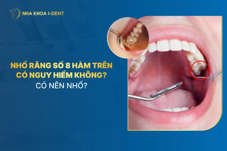 Nhổ Răng Số 8 Hàm Trên Có Nguy Hiểm Không? Có Nên Nhổ?