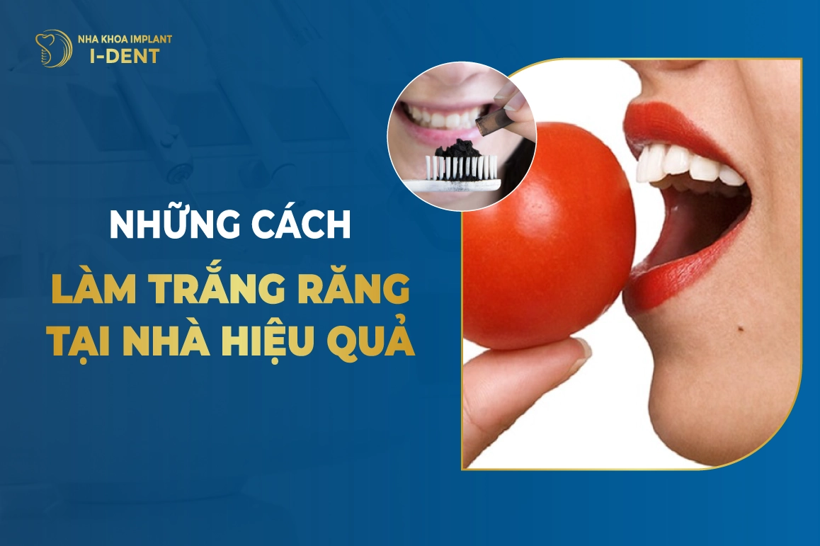 Nhung Cach Tay Trang Rang Tai Nha Hieu Qua