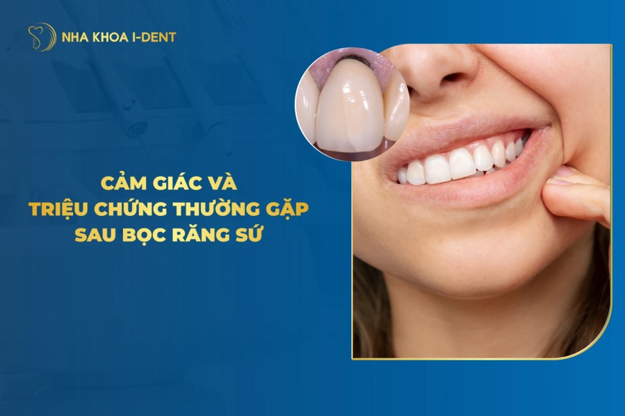 Nhung Cam Giac Sau Khi Boc Rang Su