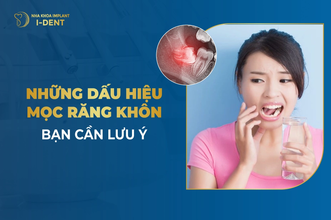 Nhung Dau Hieu Moc Rang Khon Ban Can Luu Y