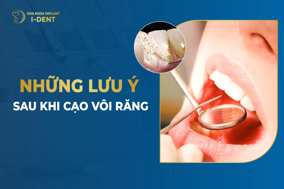 Nhung Luu Y Sau Khi Cao Voi Rang