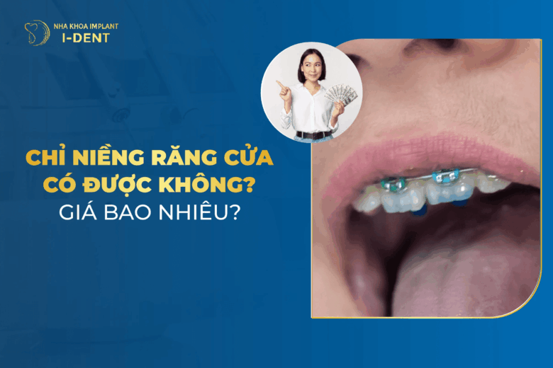 Niềng 2 Răng Cửa Được Không? Chi Phí Niềng 2 Răng Cửa