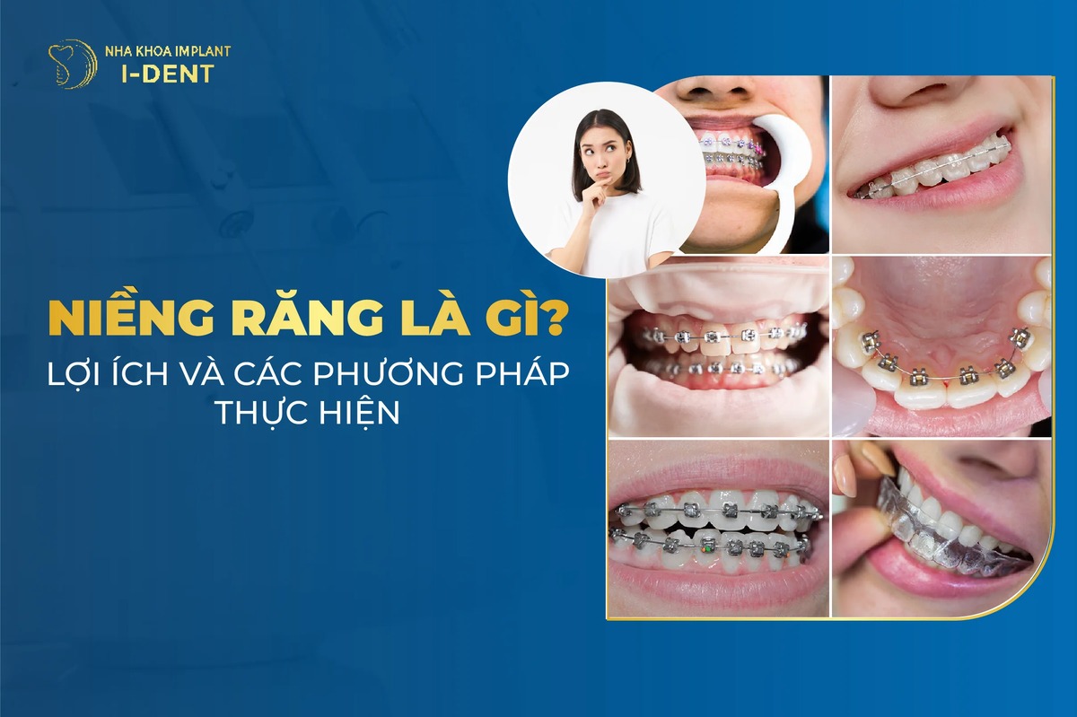 Nieng Rang