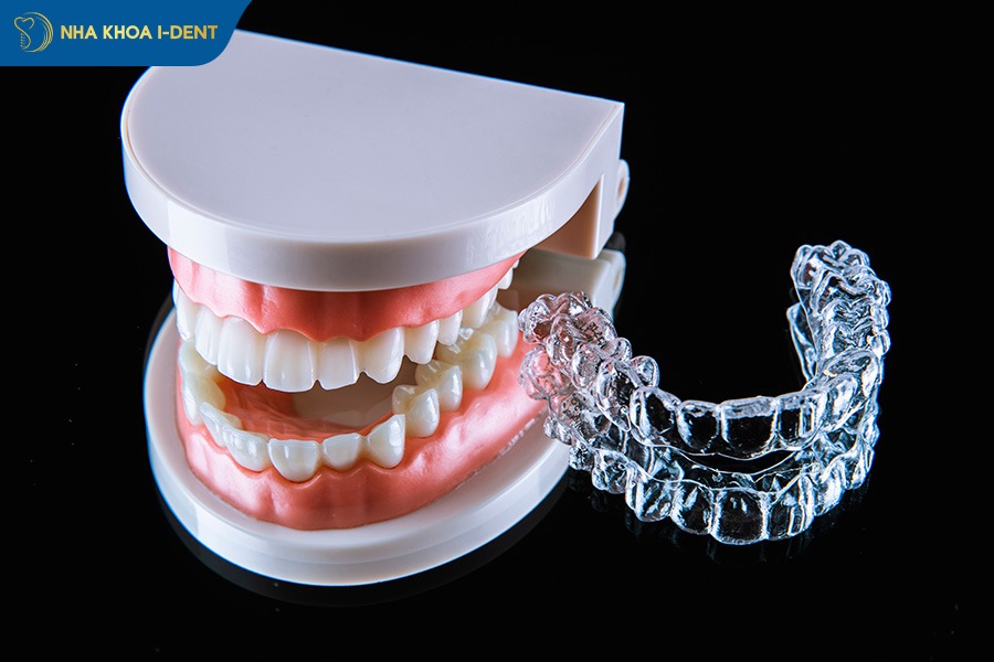 niềng răng 3d