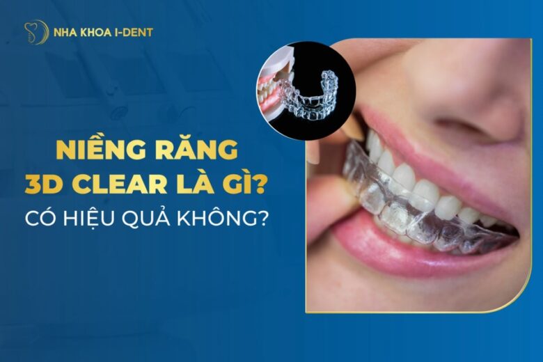 Niềng Răng 3D Clear: Chi Phí Và Hiệu Quả Điều Trị