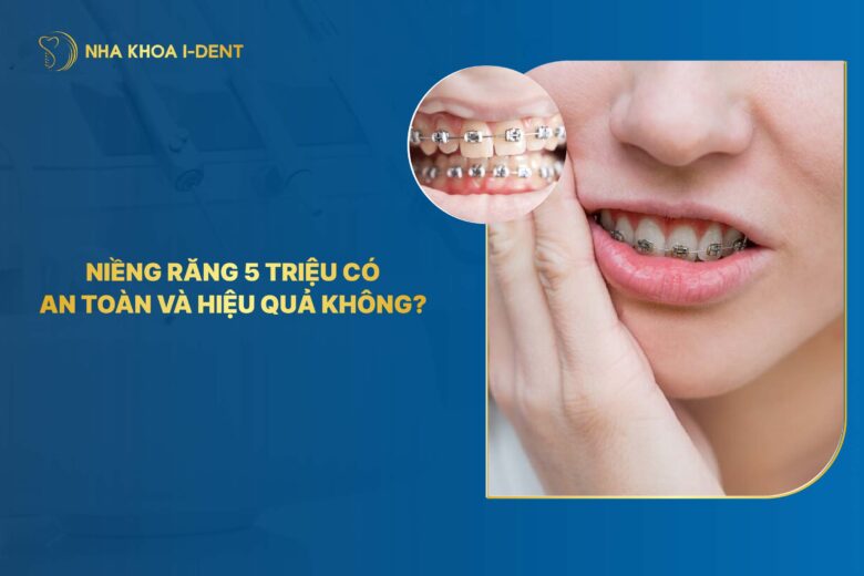 Niềng Răng 5 Triệu Có An Toàn Và Hiệu Quả? Chi Phí Thực Tế