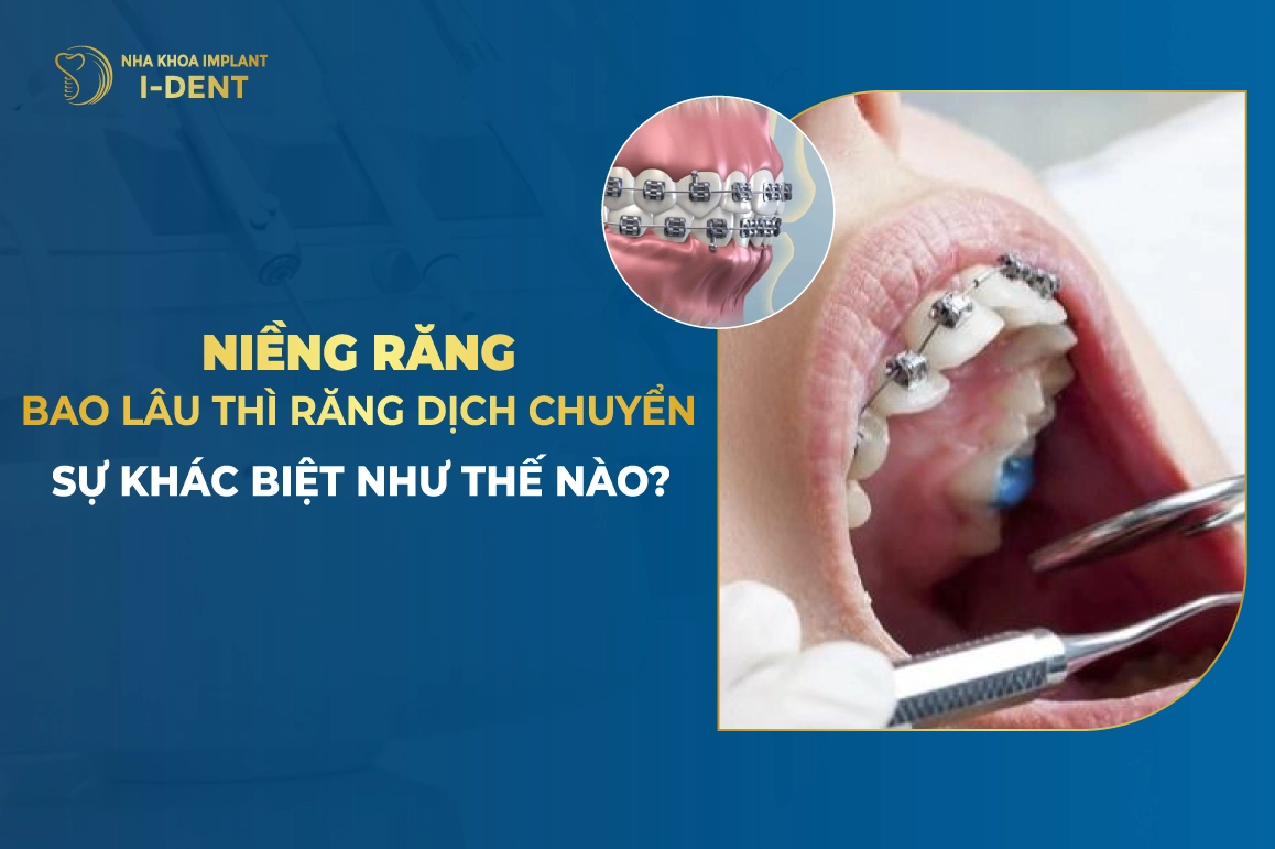 Nieng Rang Bao Lau Thi Rang Dich Chuyen