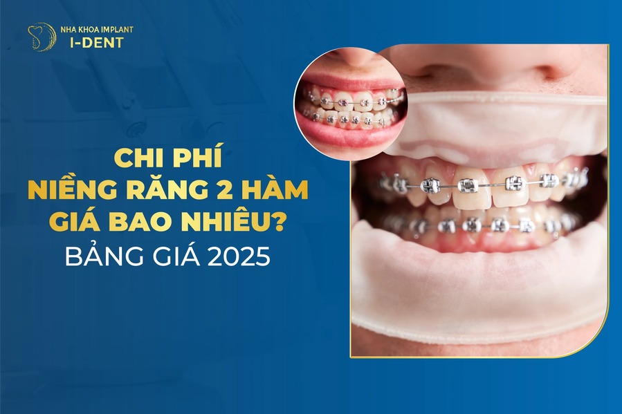 Nieng Rang Bao Nhieu Tien 2 Ham