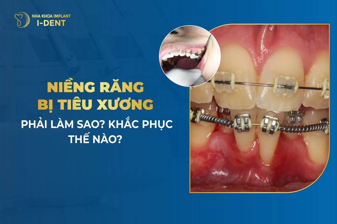 Nieng Rang Bi Tieu Xuong Phai Lam Sao Khac Phuc The Nao