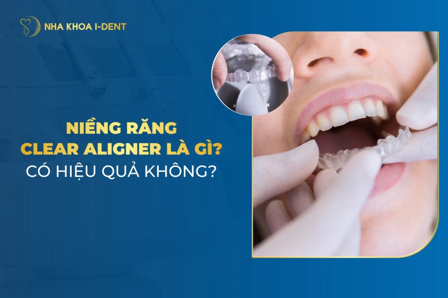 Nieng Rang Clear Aligner
