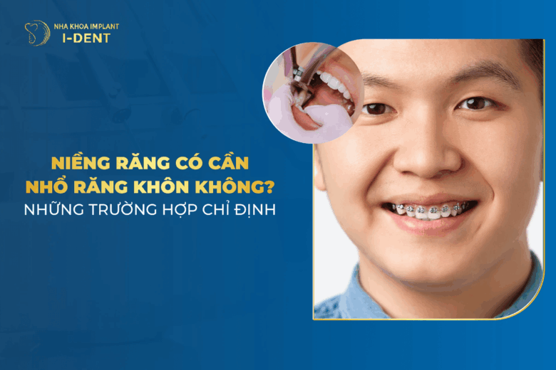 Niềng Răng Có Cần Phải Nhổ Răng Khôn?