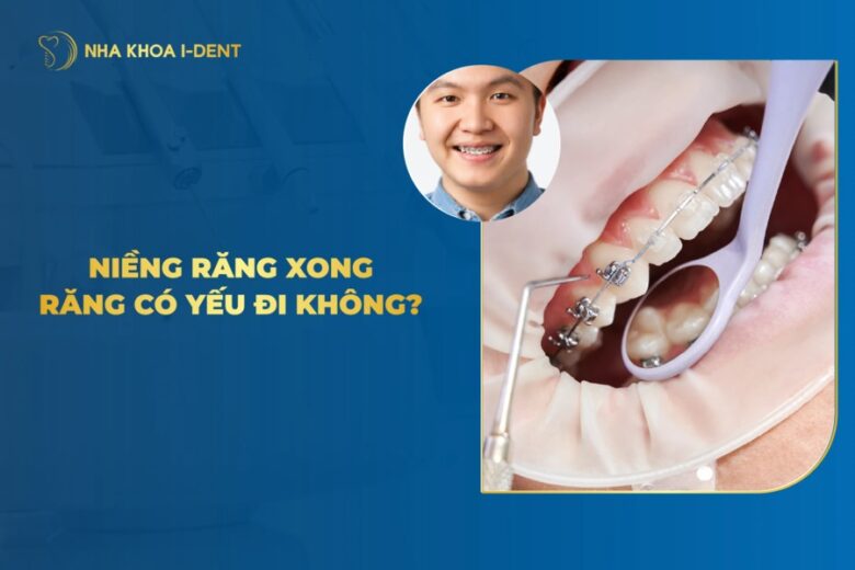 Niềng Răng Có Làm Răng Bị Yếu Đi Không?