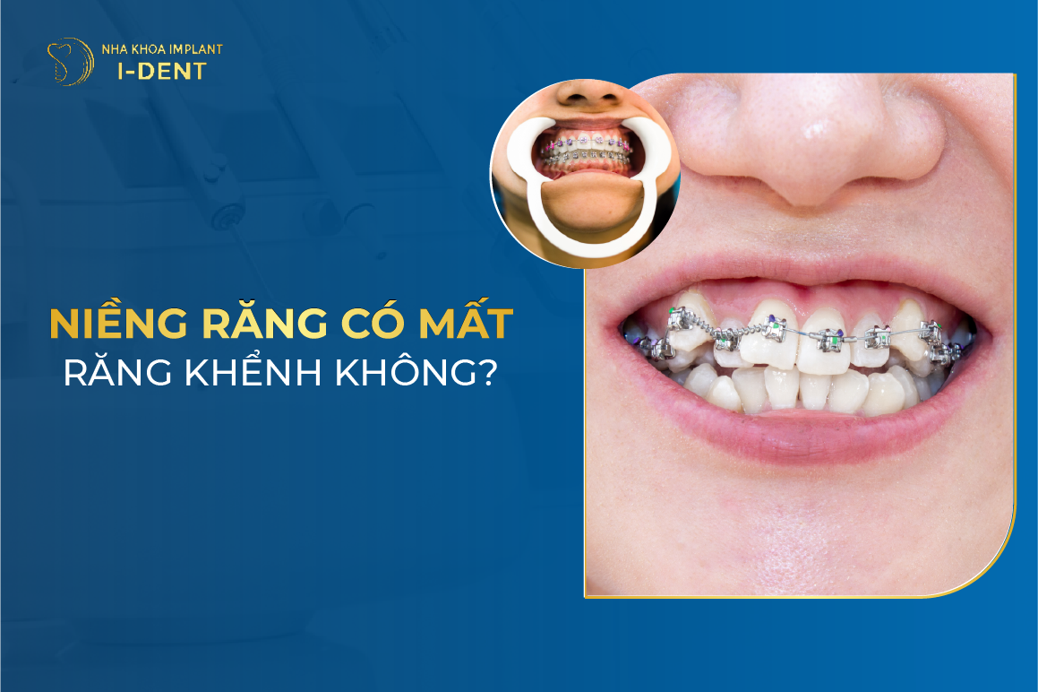 Nieng Rang Co Mat Rang Khenh Khong