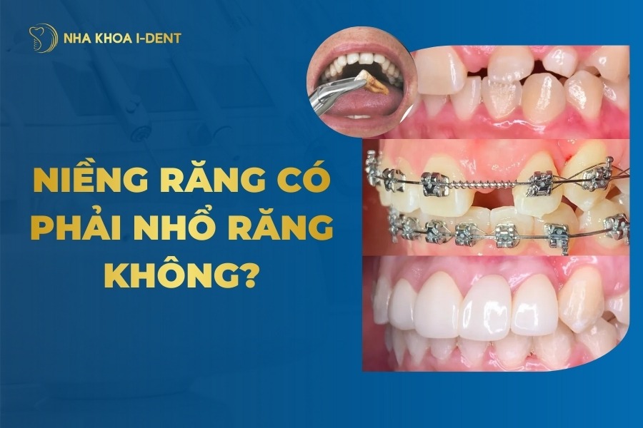 Nieng Rang Co Phai Nho Rang Khong