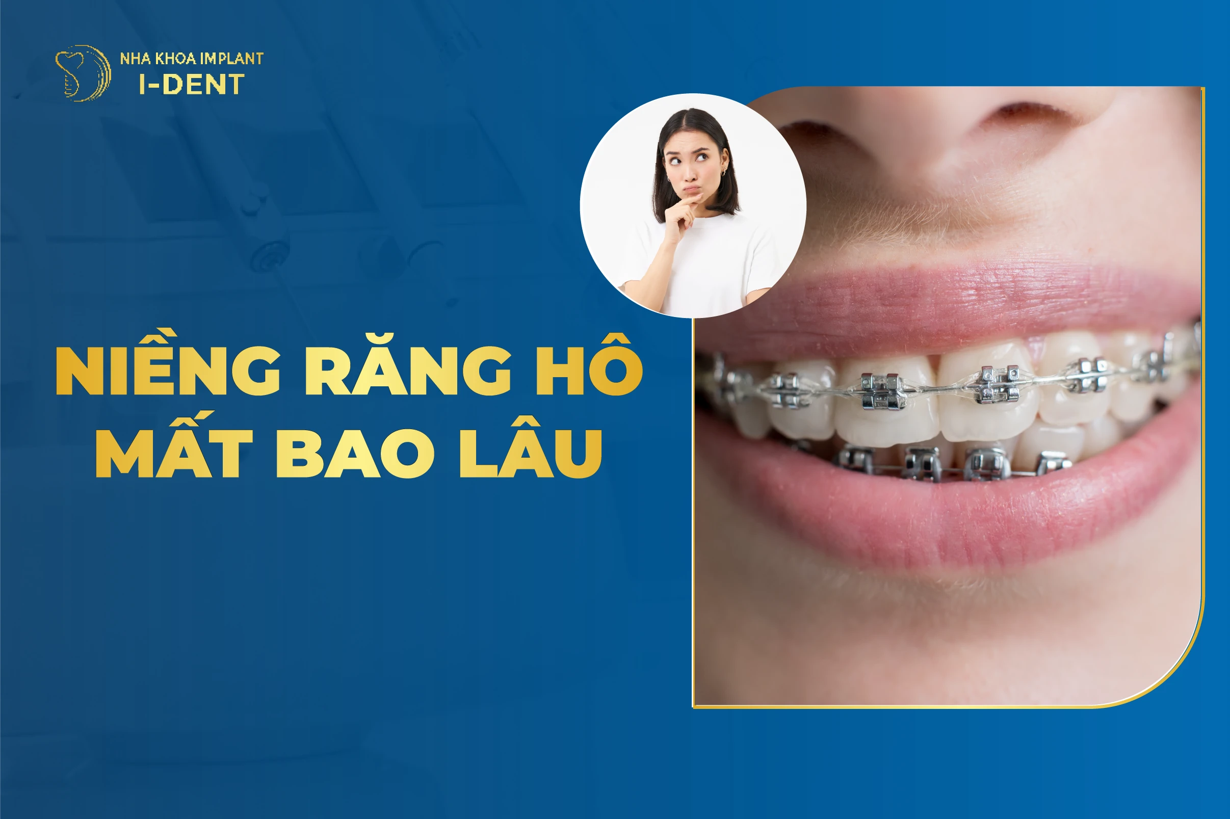 Nieng Rang Ho Mat Nao Lau