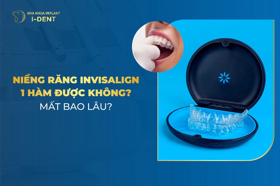 Nieng Rang Invisalign 1 Ham
