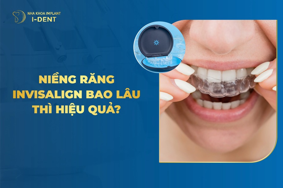 Nieng Rang Invisalign Mat Bao Lau