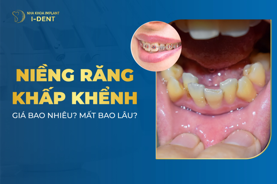 Nieng Rang Khap Khenh E1770785309487