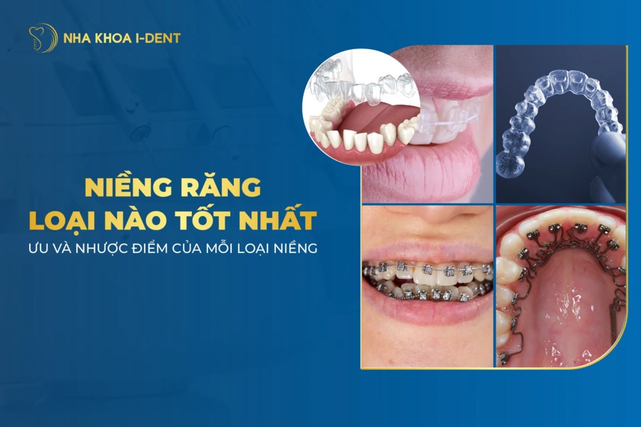 Nieng Rang Loai Nao Tot Nhat