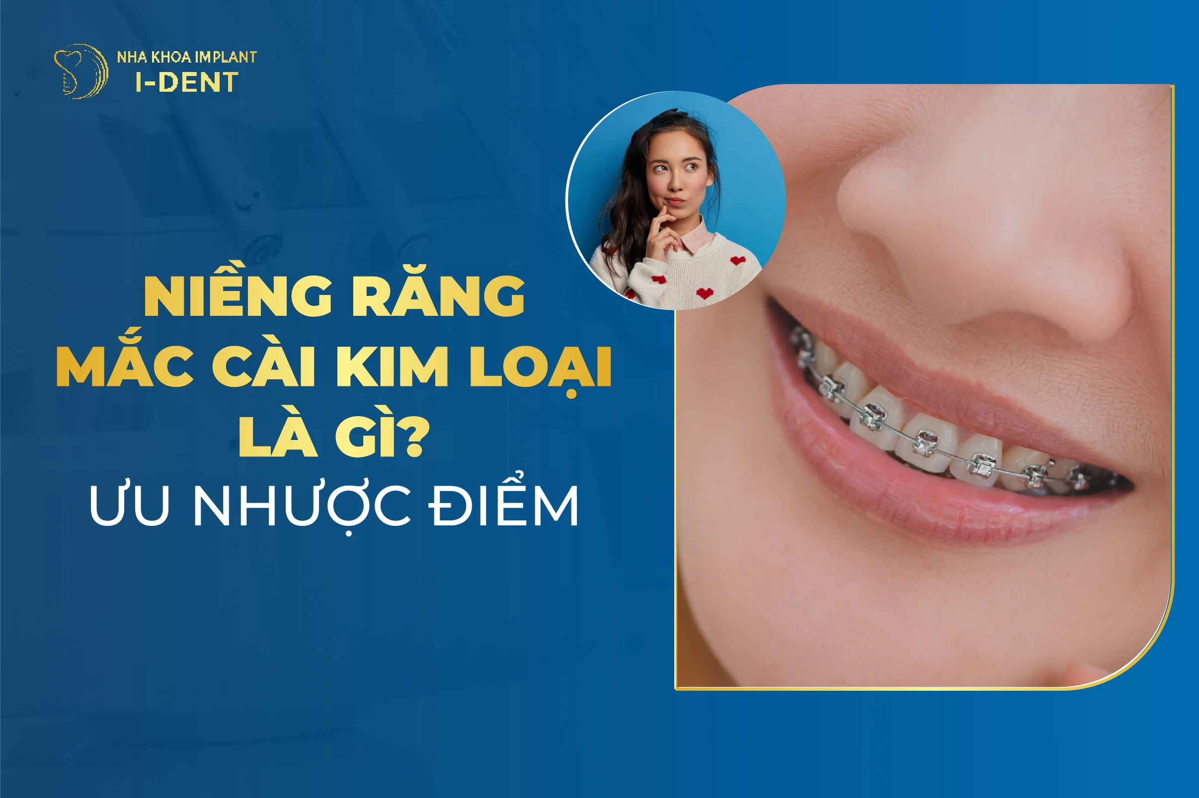 Nieng Rang Mac Cai Kim Loai
