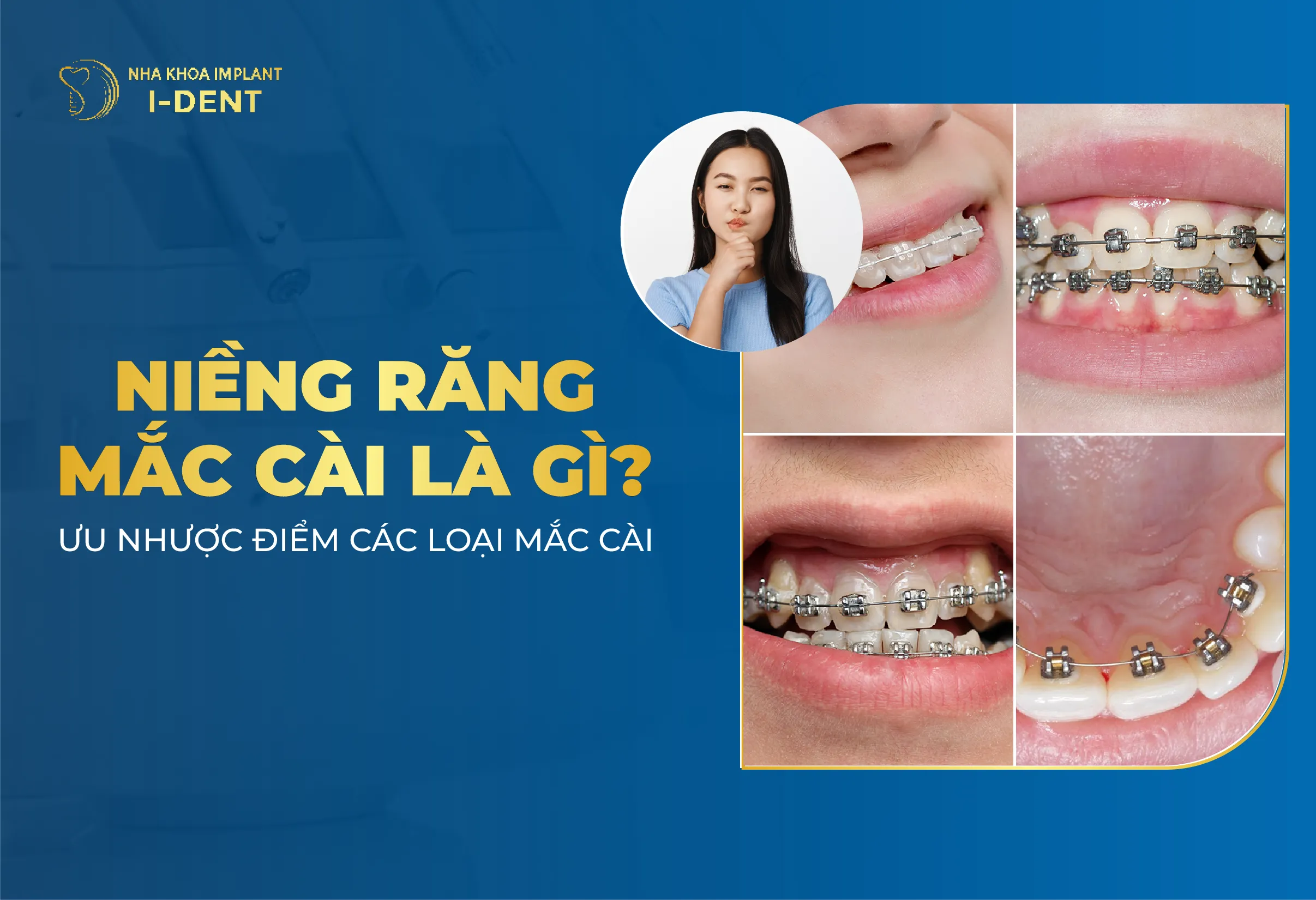 Nieng Rang Mac Cai La Gi