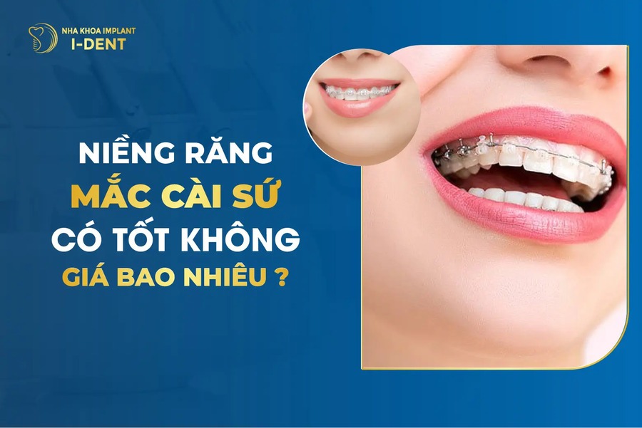 Nieng Rang Mac Cai Su