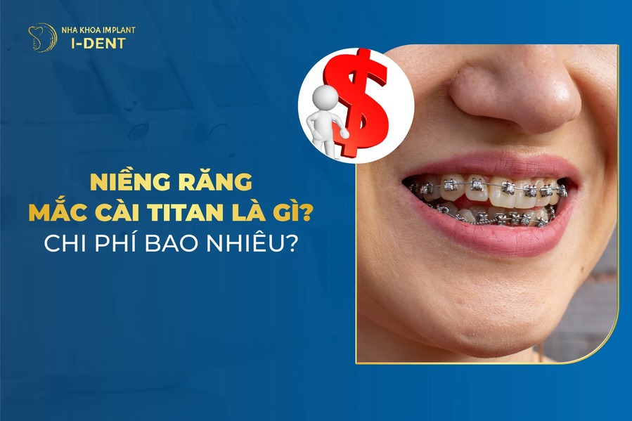 Nieng Rang Mac Cai Titan