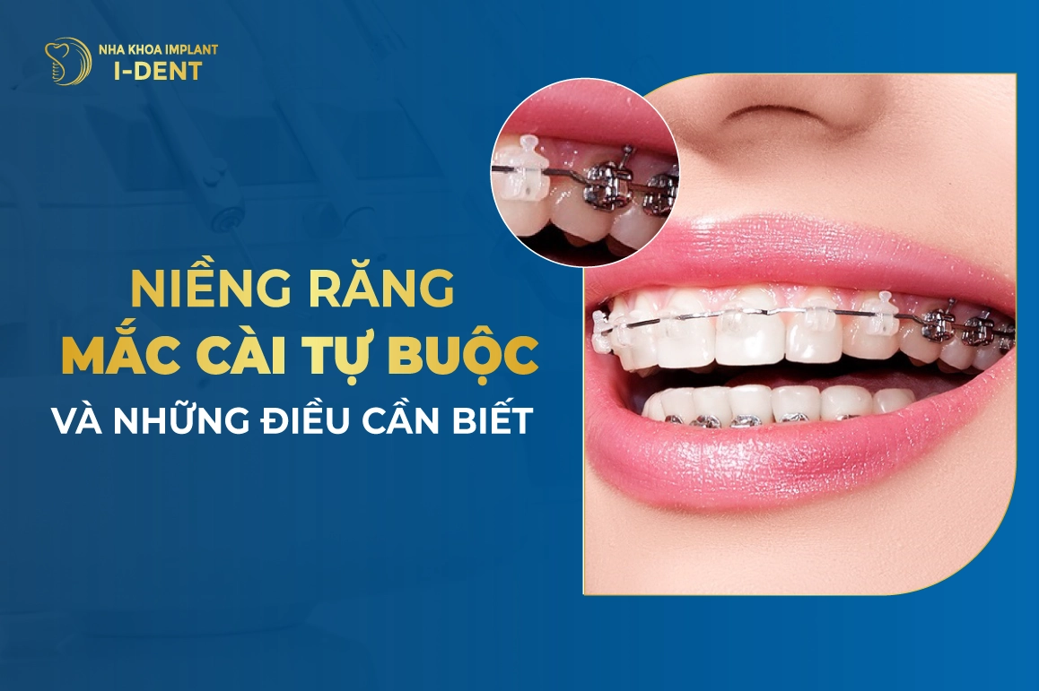 Nieng Rang Mac Cai Tu Buoc Va Nhung Dieu Can Biet